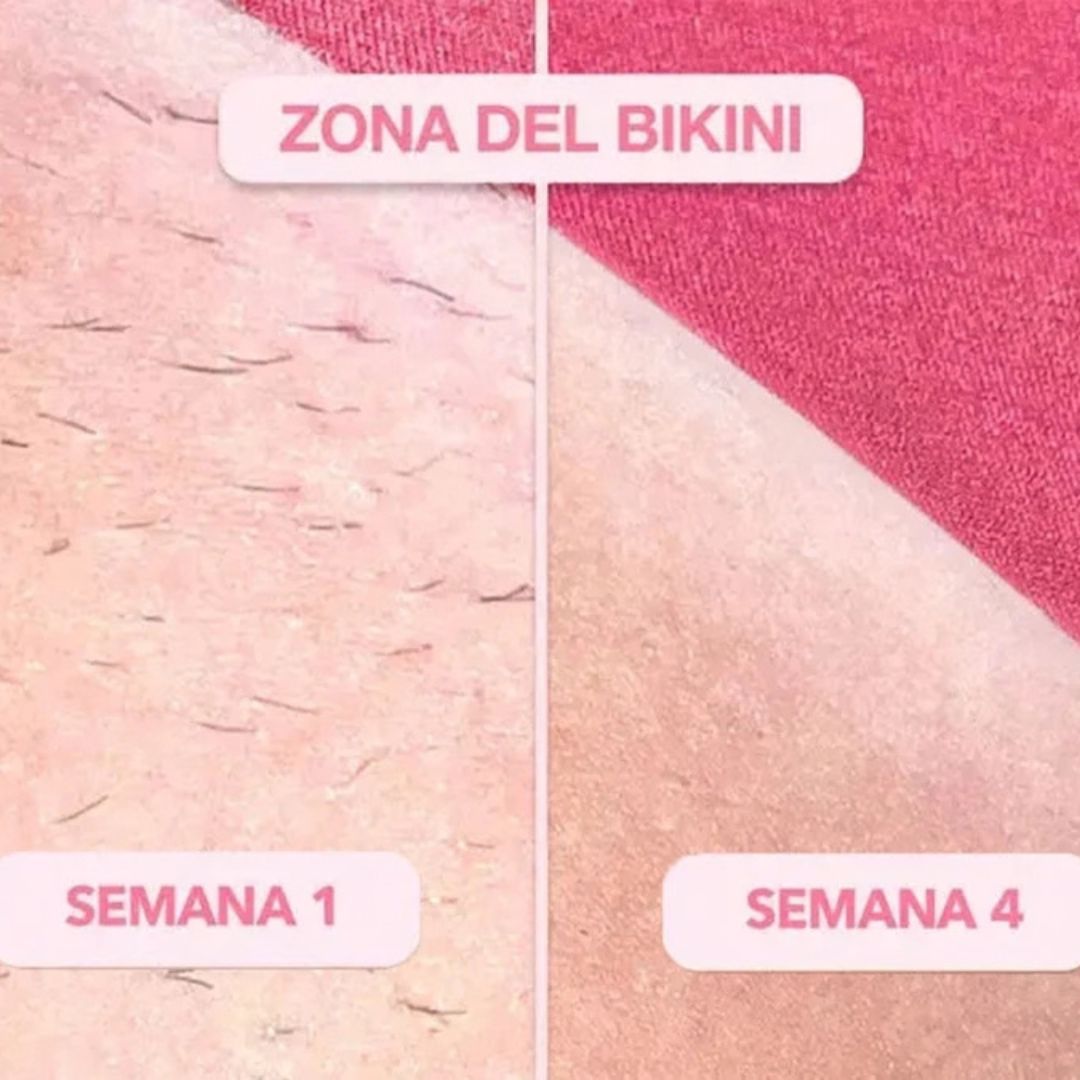 Depiladora Láser Permanente