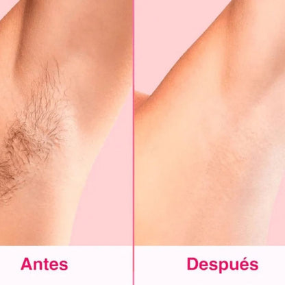 Depiladora Láser Permanente